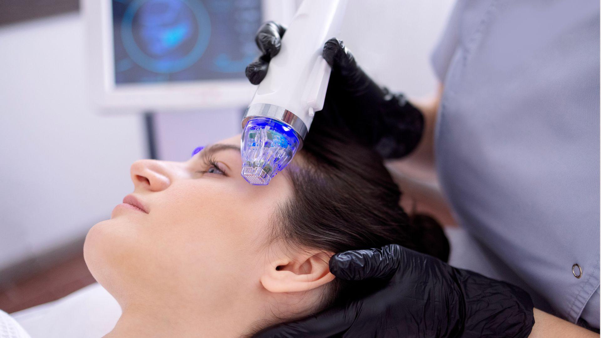 rf-microneedling-procedure-lyndhurst-what-to-expect